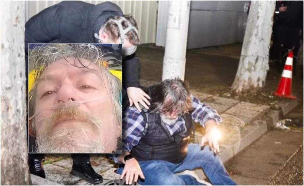 “Akoma i kam keq sytë dhe kokën!”- Polici i spërkati spraj në fytyrë gjatë protestës, fotoreporteri Bilani tregon si ndodhi ngjarja: Për 3 sekonda rashë në tokë! Jam kardiak dhe diabetik