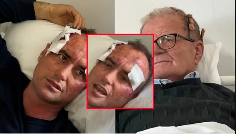 U dhunua bashkë me babain pasi komplimentoi motrën e një polici, 46-vjeçari zbulon mesazhin kërcënues: Nuk e kam ngacmuar vajzën