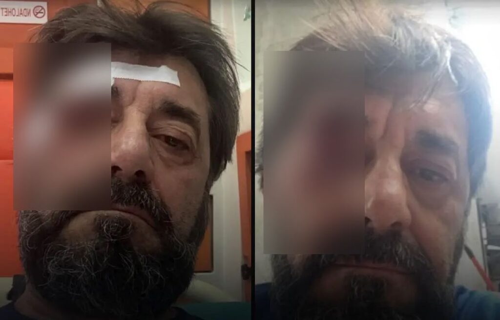 Dhunimi i Ilir Demaliajt, identifikohet dhe shpallet në kërkim autori i dyshuar! Zbardhet dëshmia e analistit