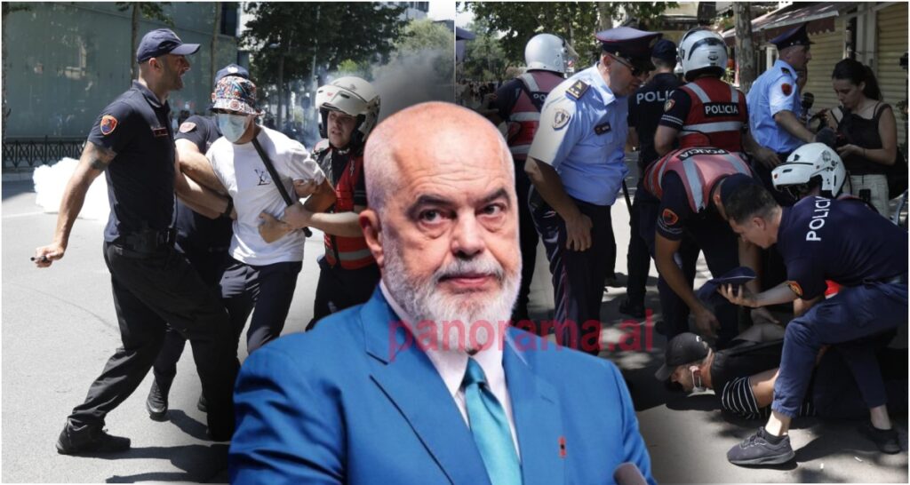 Rama sulmon sërish protestuesit: Dhuna fizike është e vetmja gjë që mund të prodhojë tanimë korja e zezë e dështakëzemërakëve të bulevardit!