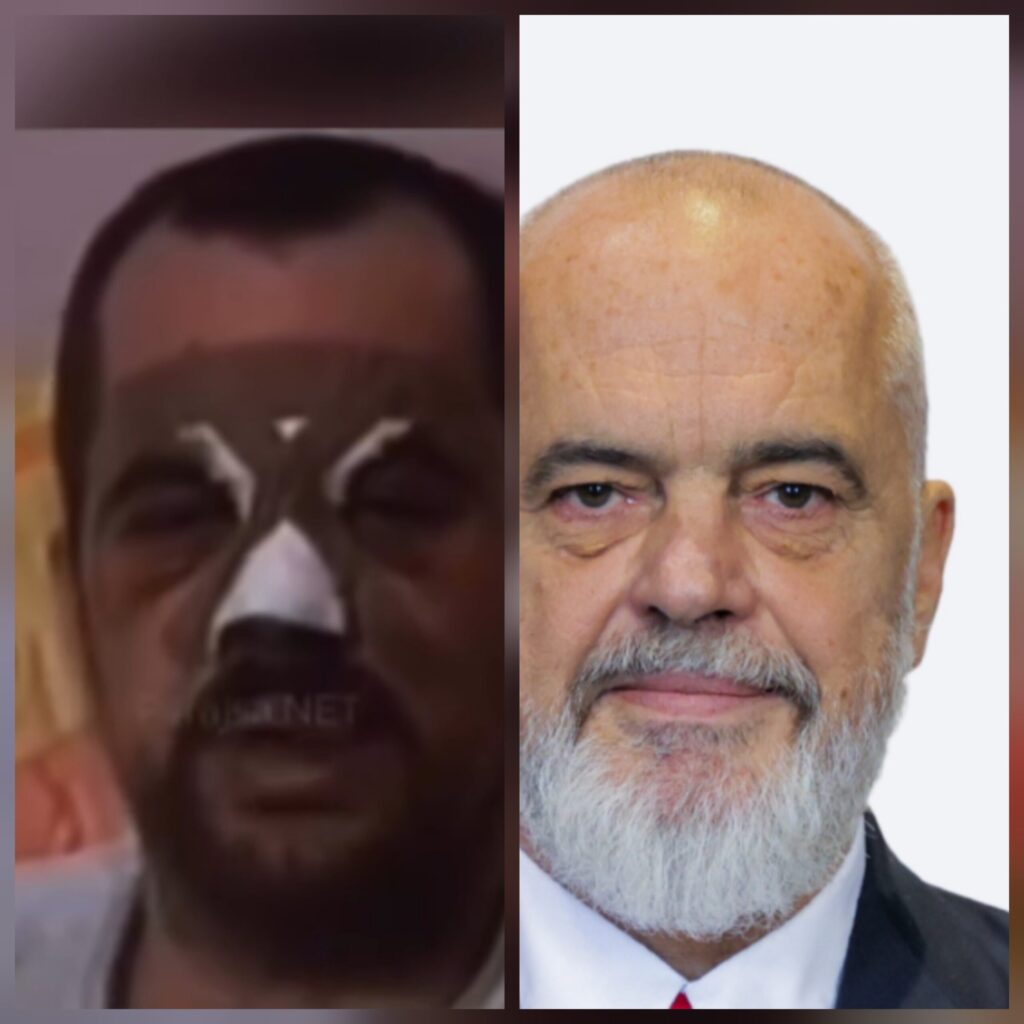 Edi Rama, nga artisti që u rrah për fjalën e lirë, te kryeministri që rreh për të mbajtur me çdo kusht kolltukun